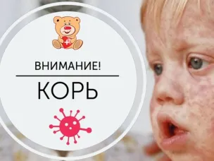 Профилактика кори