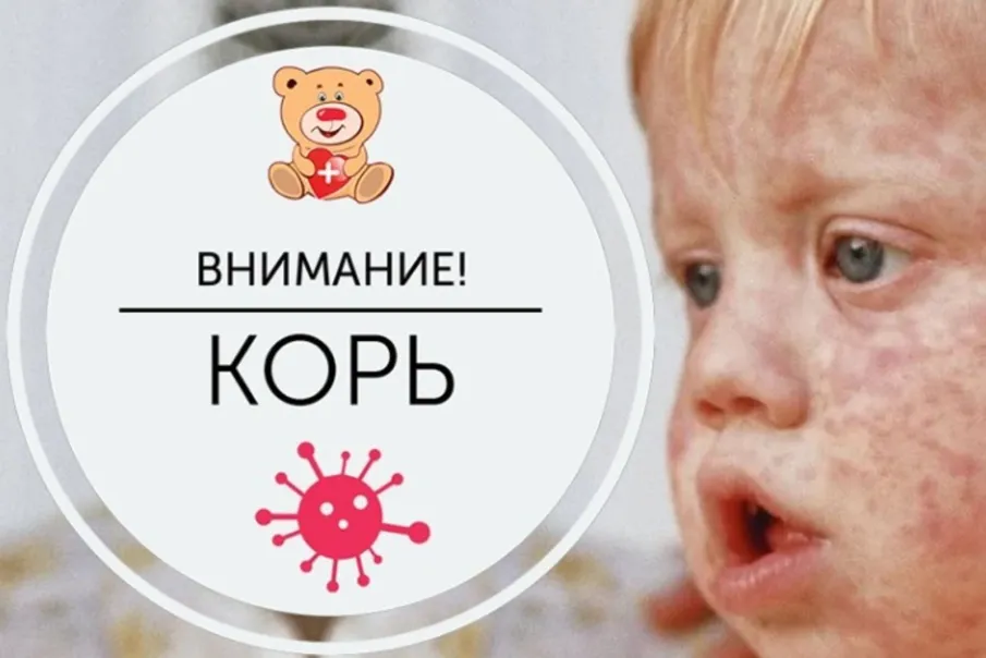 Профилактика кори